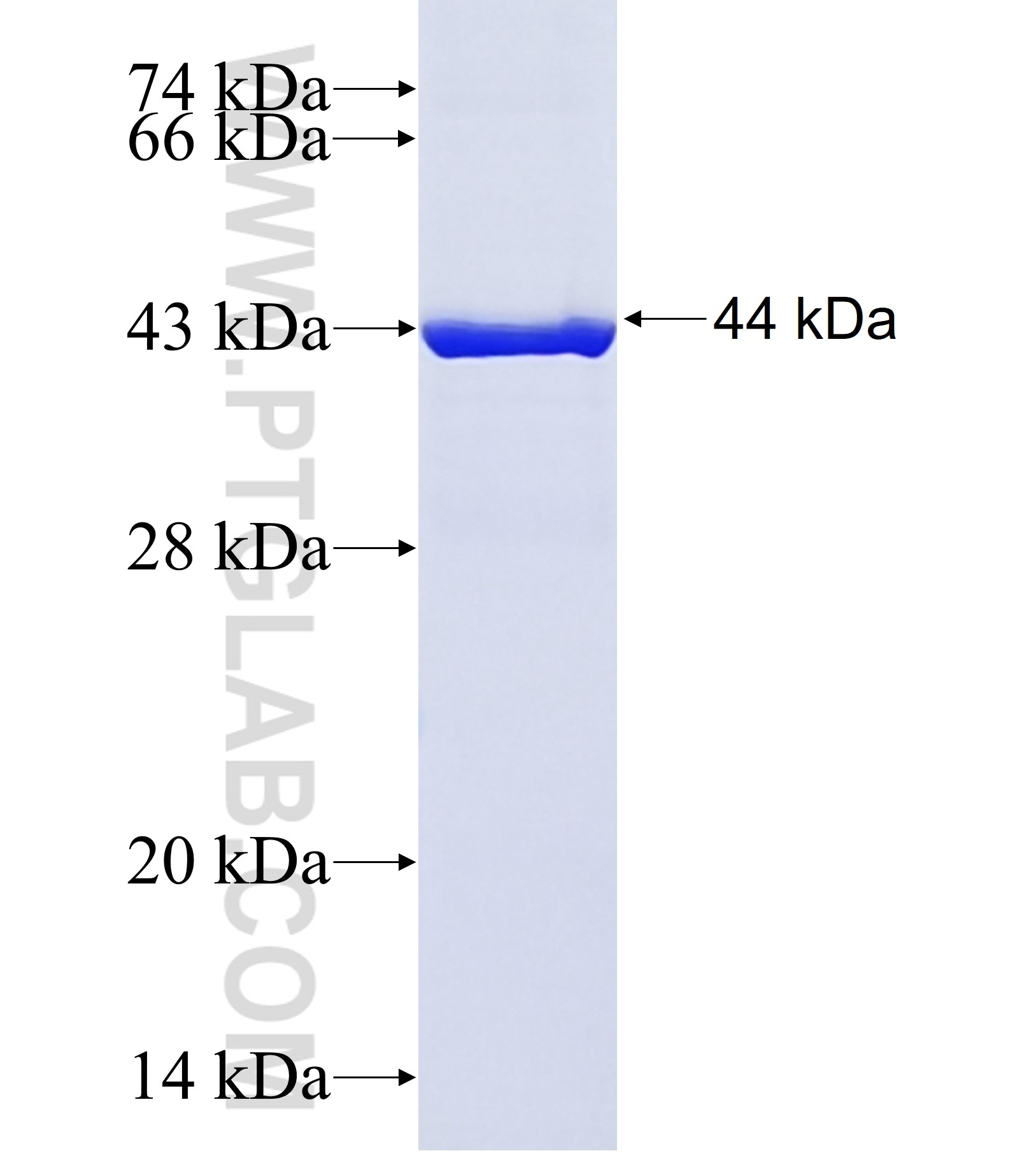 IL-18 fusion protein Ag42146 SDS-PAGE IL-18 fusion protein Ag42146 SDS-PAGE