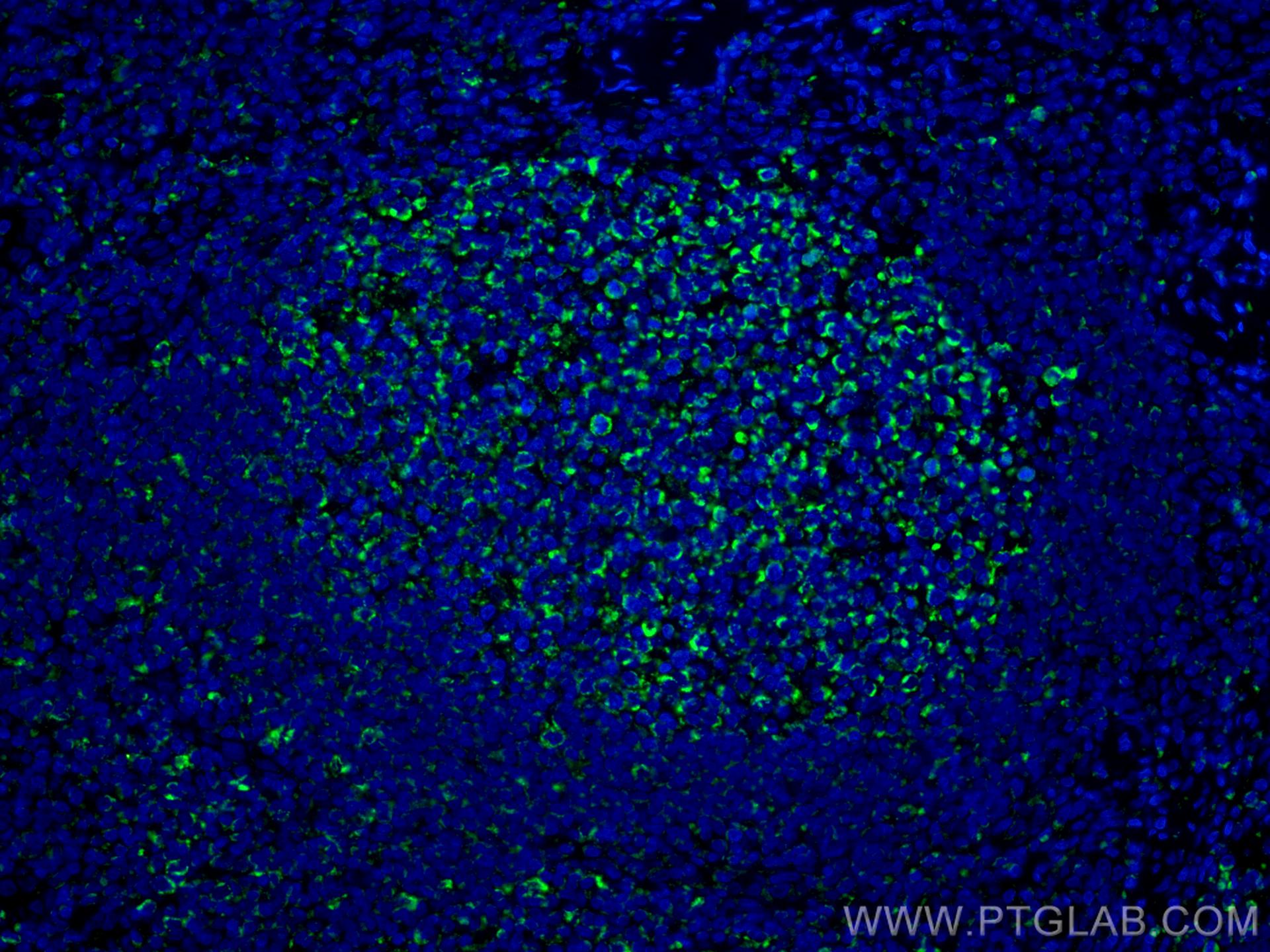 IF Staining of human tonsillitis using CL488-60278