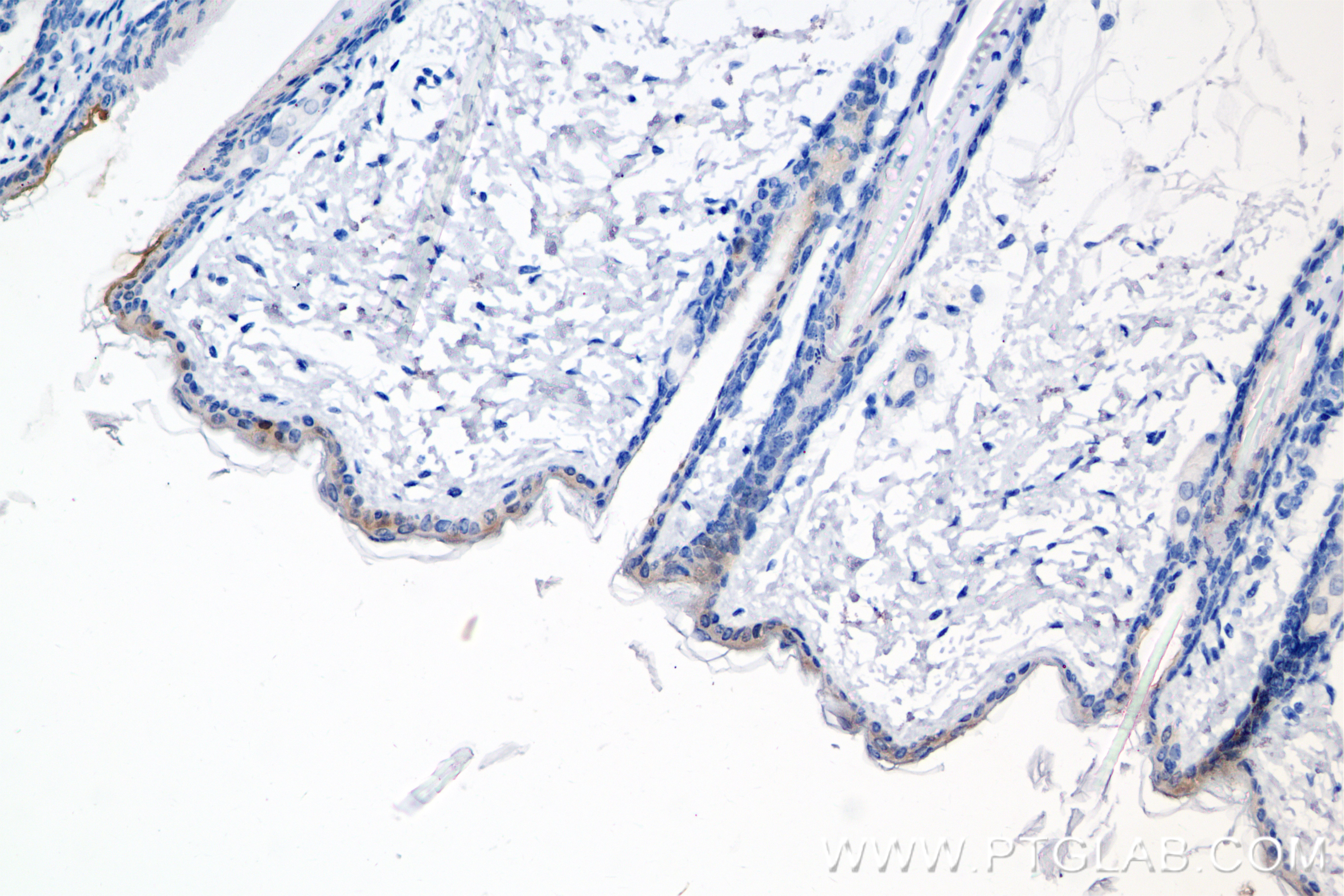 IHC staining of mouse skin using 85672-3-RR