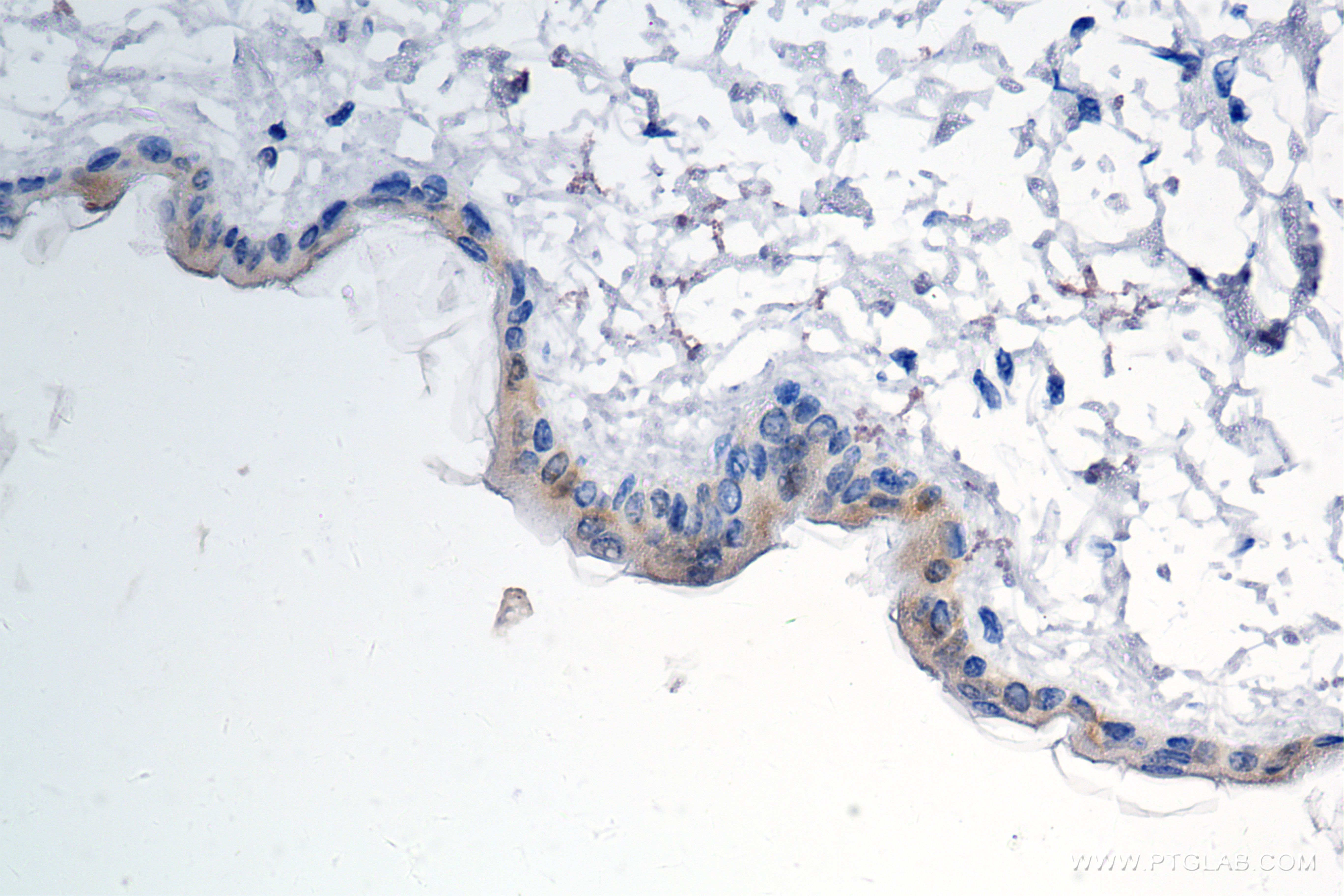 IHC staining of mouse skin using 85672-3-RR