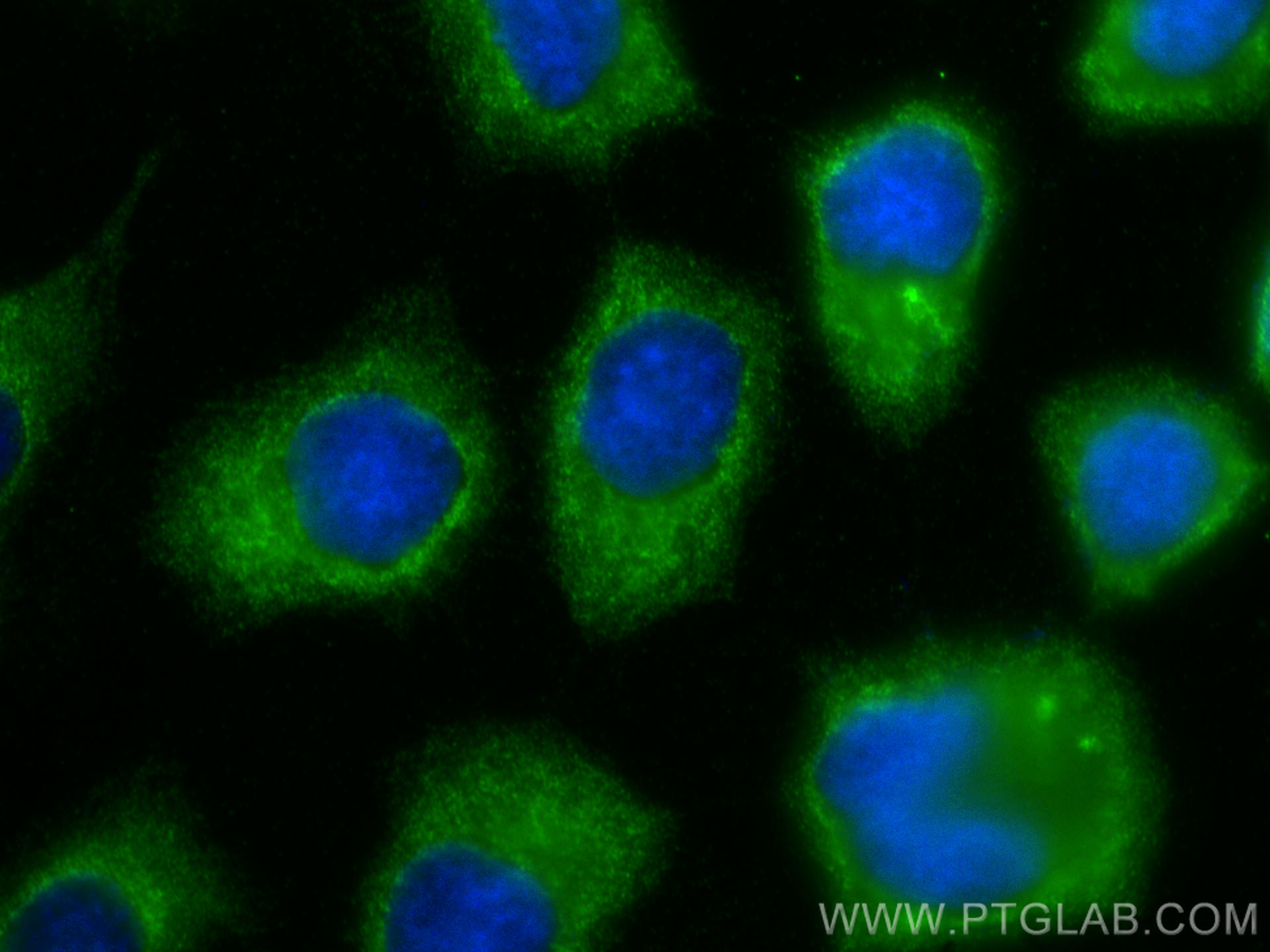 IF Staining of A431 using 31127-1-AP