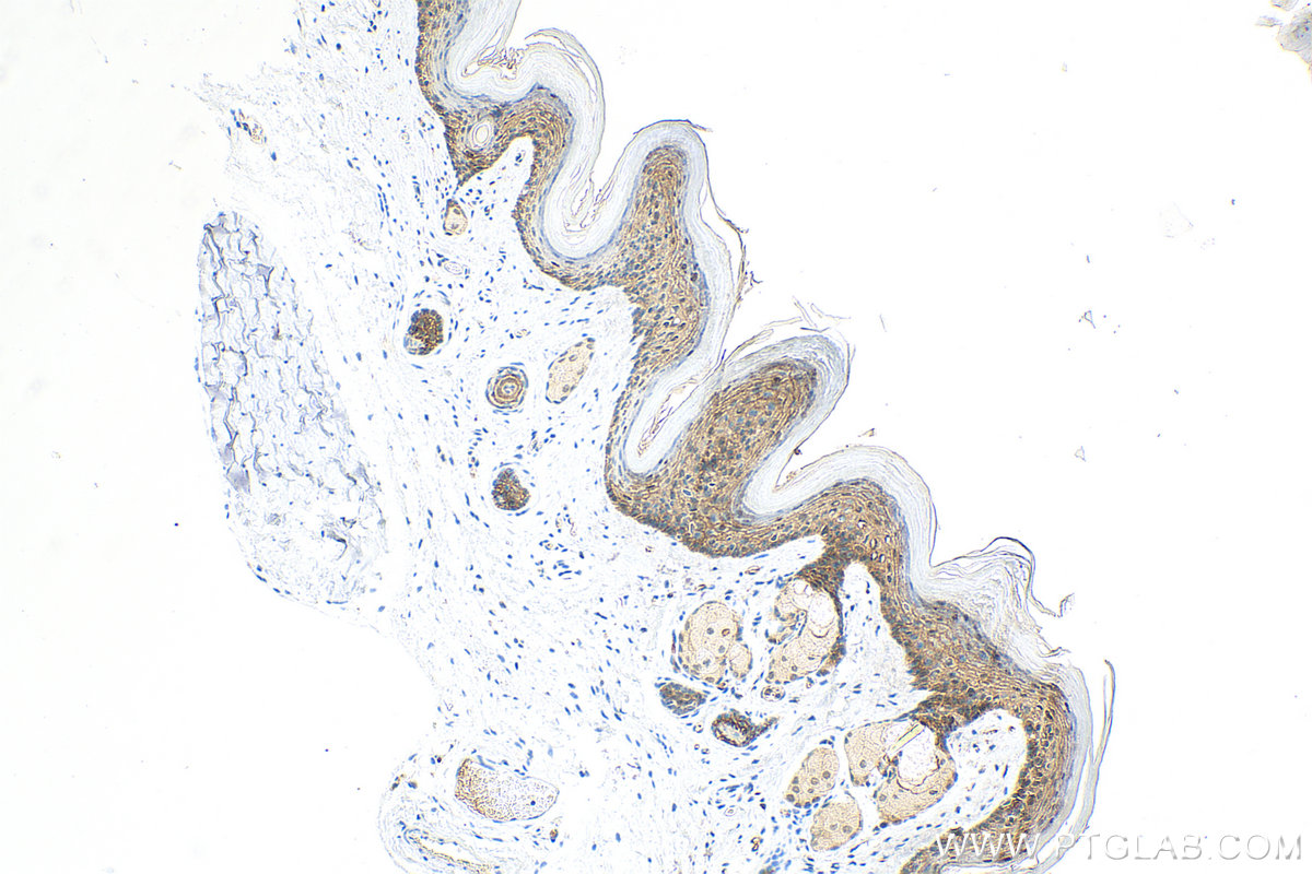 IHC staining of mouse skin using 83335-4-RR (same clone as 83335-4-PBS)