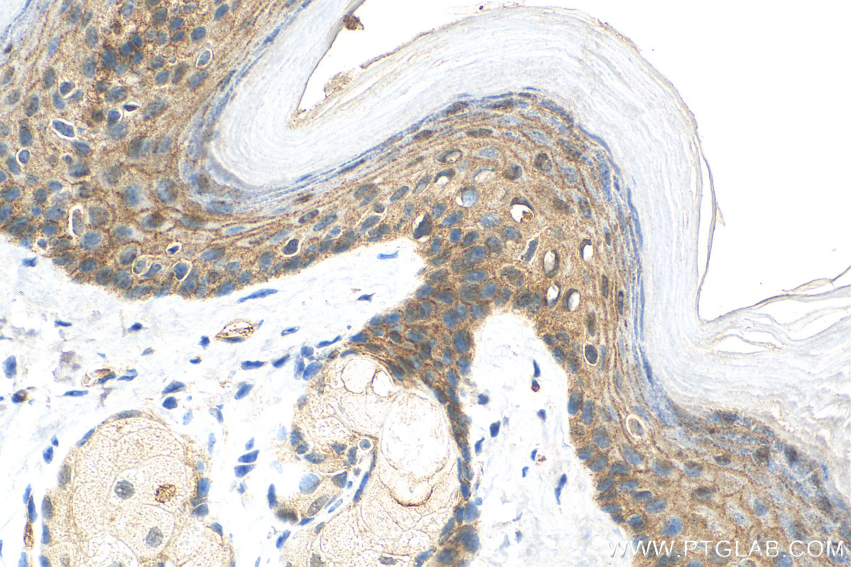 IHC staining of mouse skin using 83335-4-RR (same clone as 83335-4-PBS)