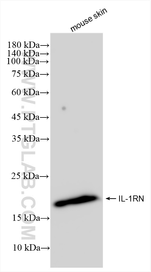 WB analysis of mouse skin using 83335-4-RR (same clone as 83335-4-PBS)