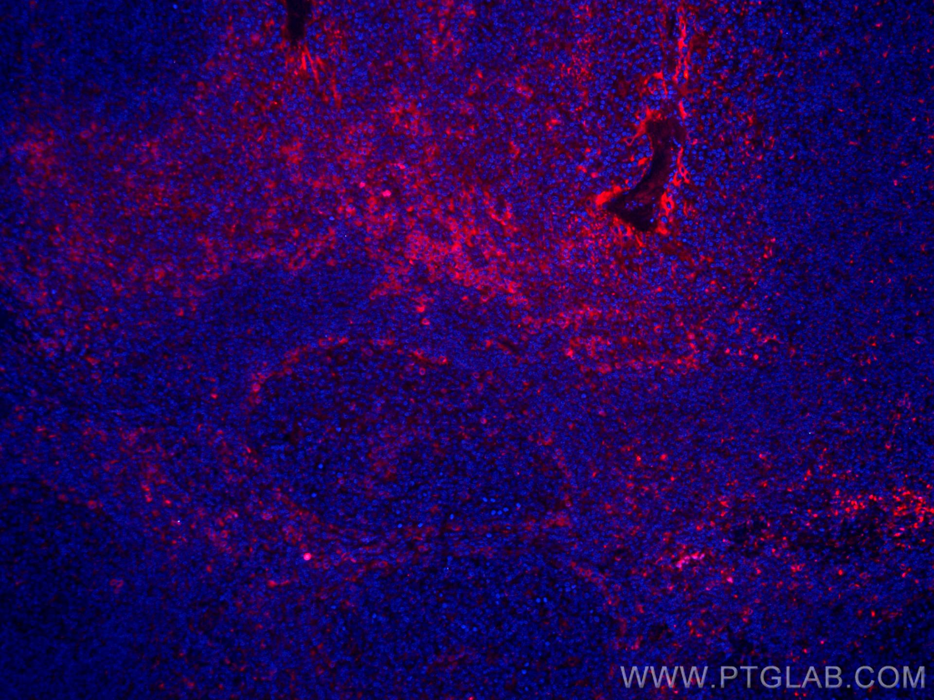 IF Staining of human tonsillitis using CL594-60306