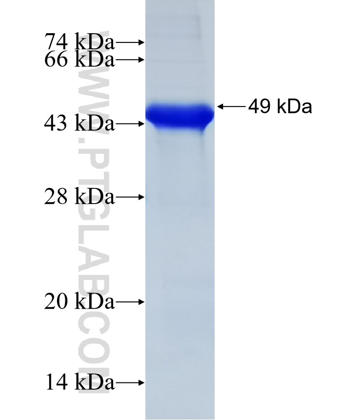 IL-21R fusion protein Ag31764 SDS-PAGE IL-21R fusion protein Ag31764 SDS-PAGE