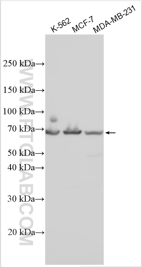 WB analysis using 31798-1-AP