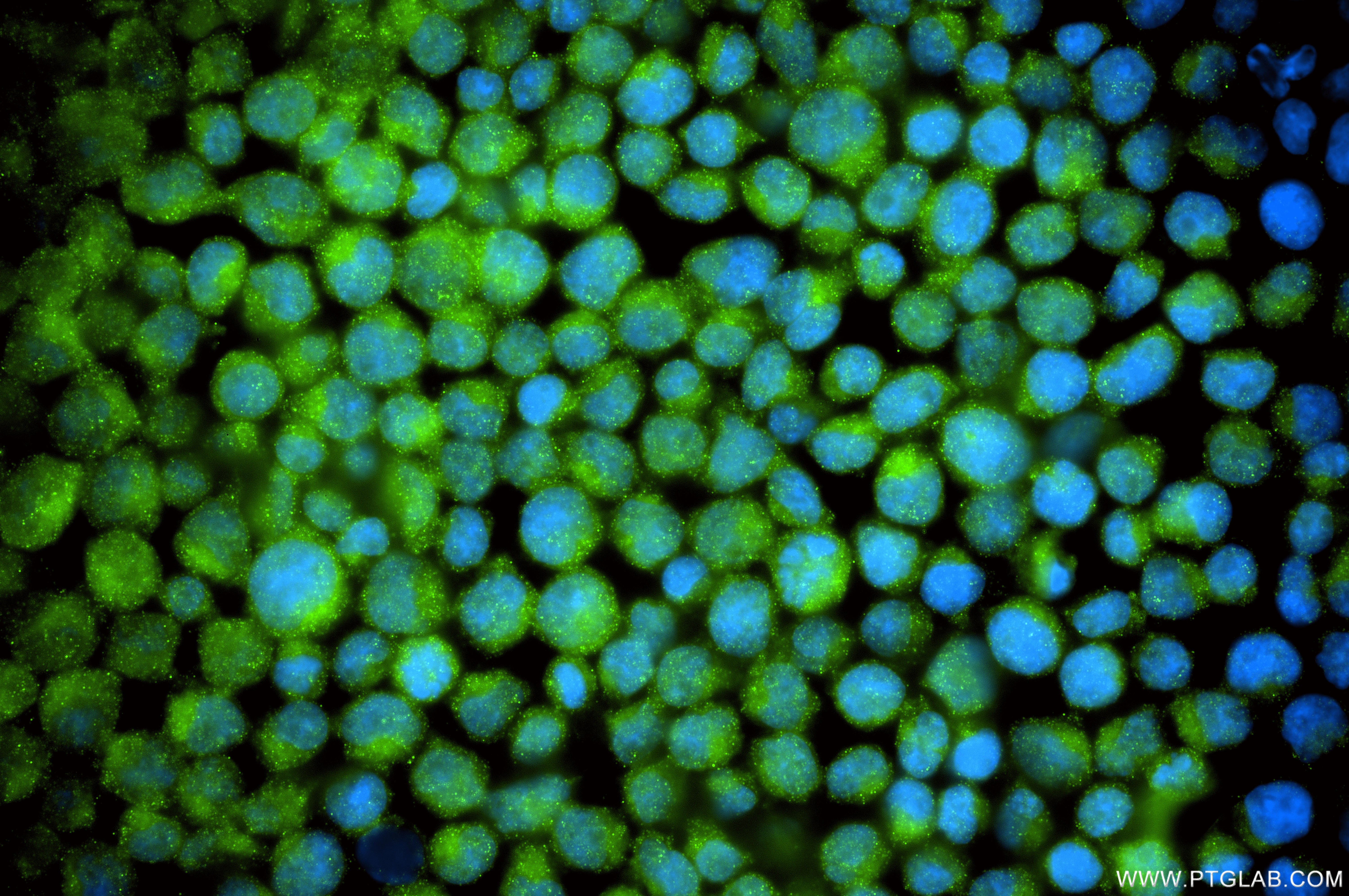 IF Staining of Jurkat using 87821-1-RR (same clone as 87821-1-PBS) IF Staining of Jurkat using 87821-1-RR (same clone as 87821-1-PBS)