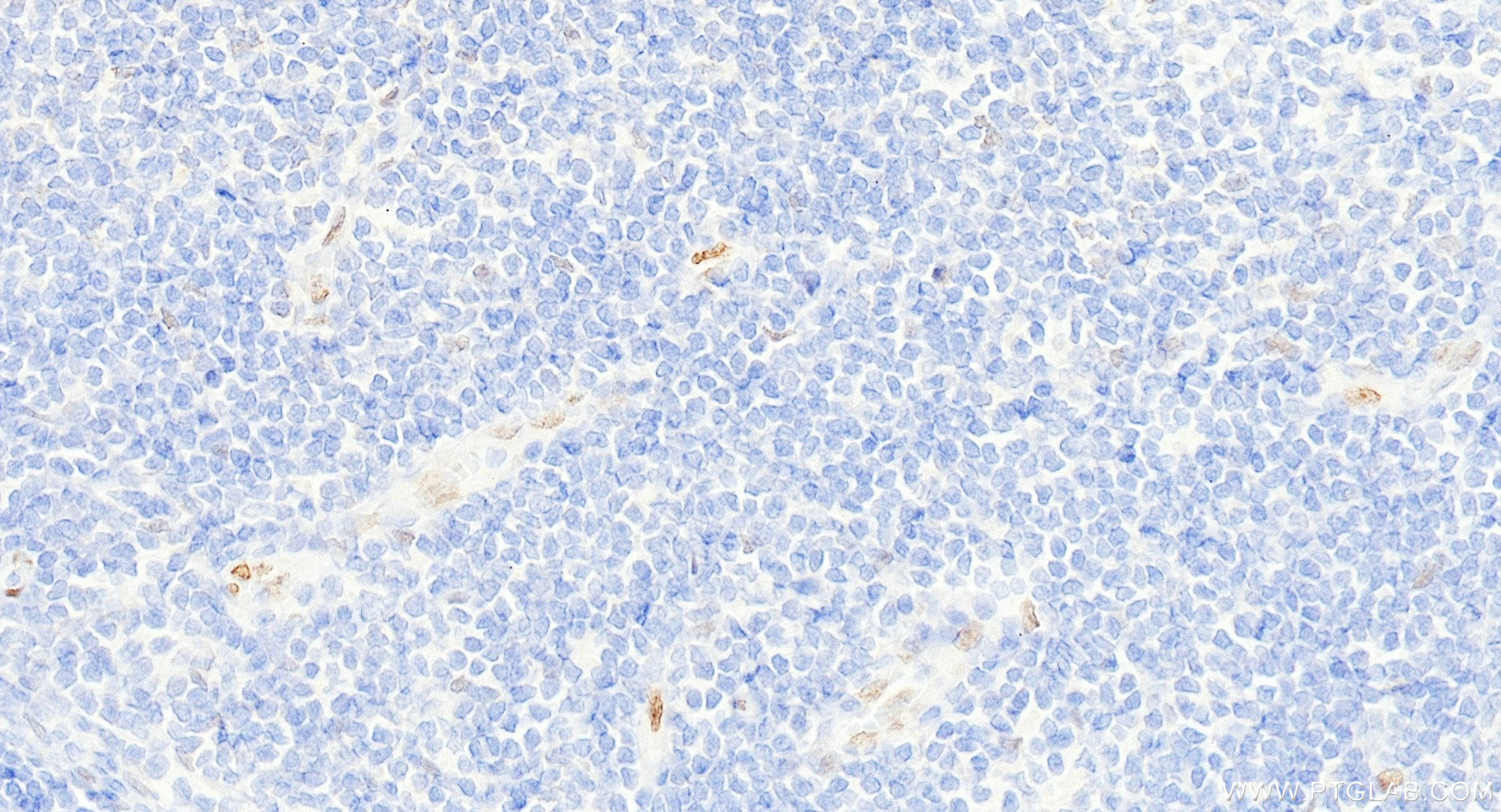 IHC staining of human colon using 98364-2-RR (same clone as 98364-2-PBS) IHC staining of human colon using 98364-2-RR (same clone as 98364-2-PBS)