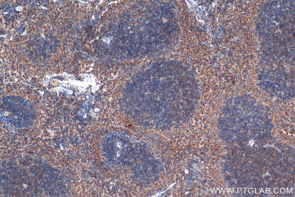 IHC staining of mouse spleen using 84758-5-RR (same clone as 84758-5-PBS)
