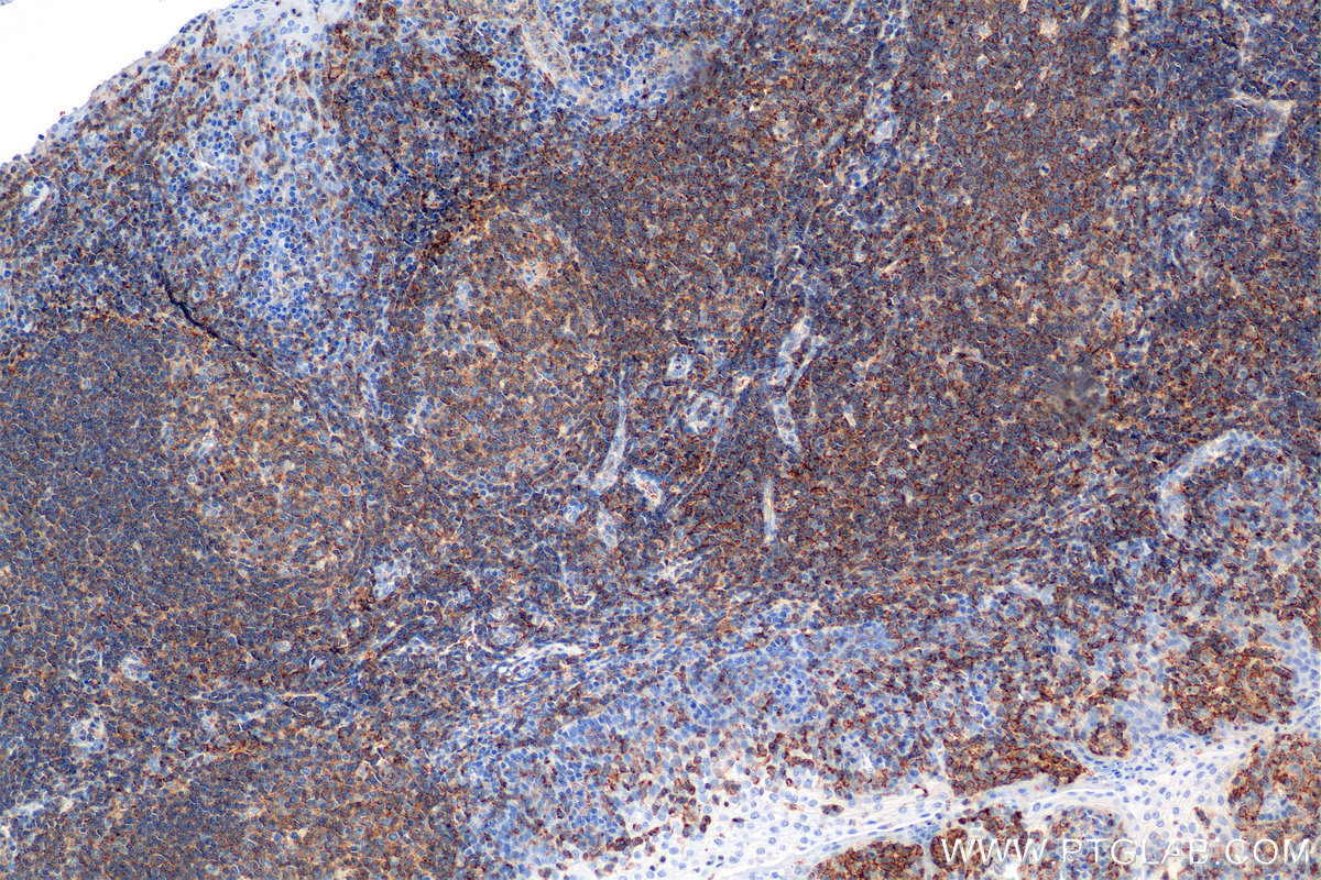 IHC staining of human tonsil using 84758-5-RR (same clone as 84758-5-PBS)