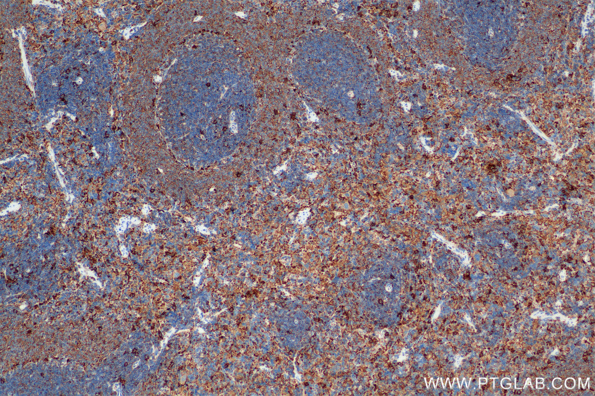 IHC staining of rat spleen using 84758-5-RR (same clone as 84758-5-PBS)