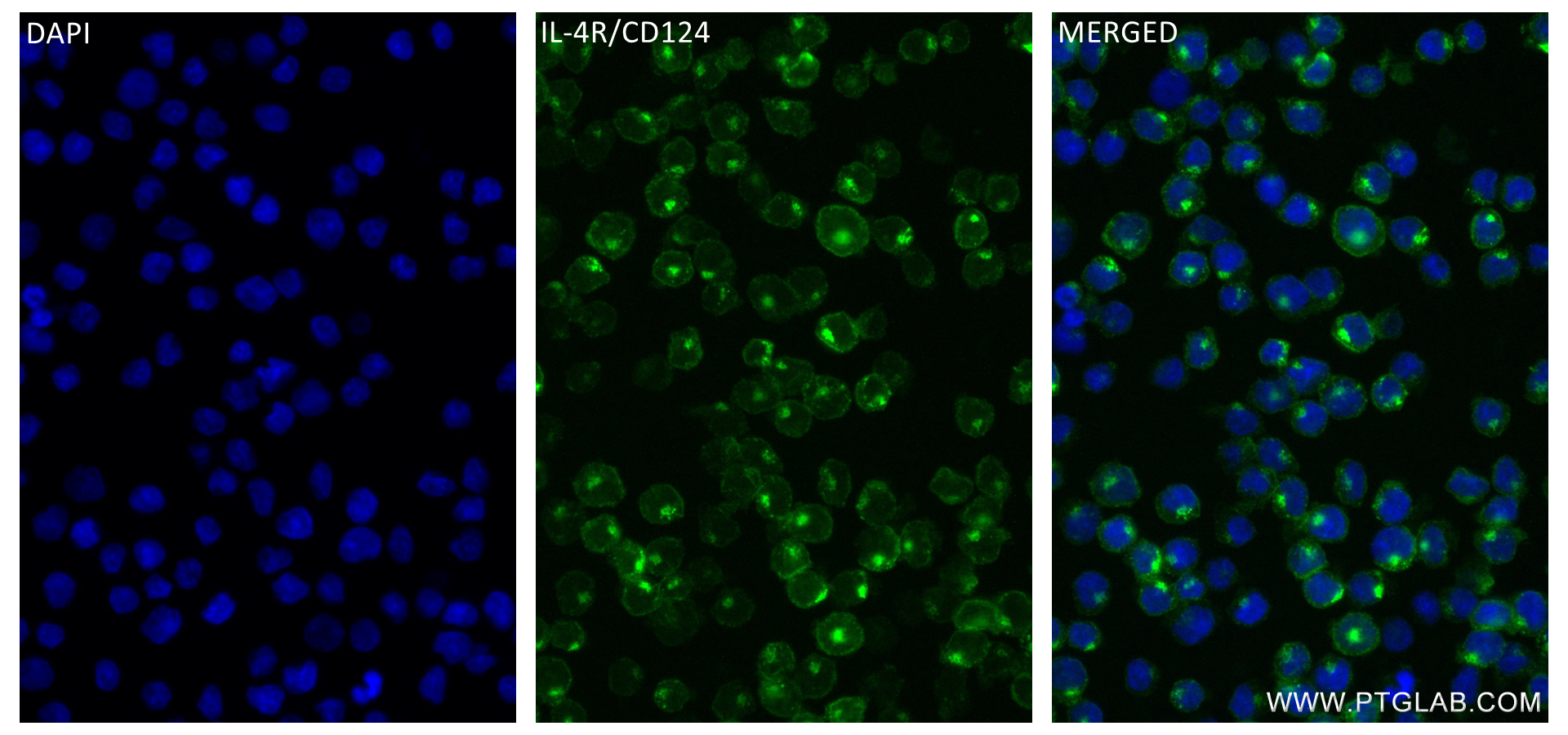 IF Staining of Daudi using 84414-6-RR