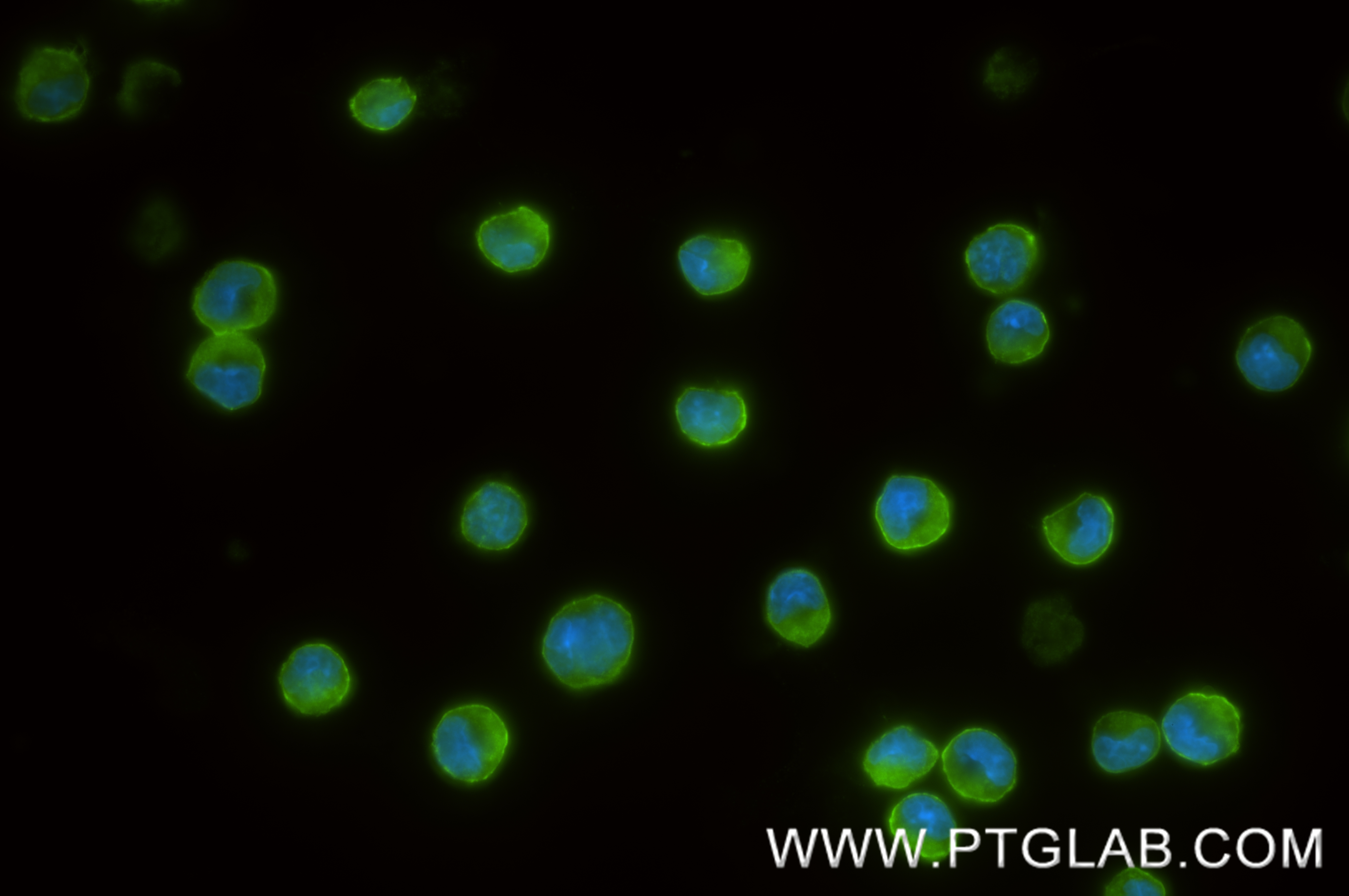IF Staining of MC/9 using 84948-5-RR (same clone as 84948-5-PBS) IF Staining of MC/9 using 84948-5-RR (same clone as 84948-5-PBS)