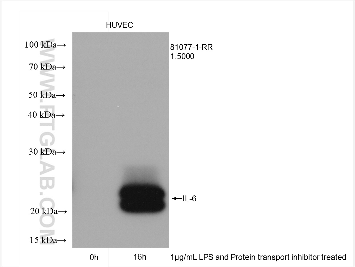 WB analysis of HUVEC using 81077-1-RR (same clone as 81077-1-PBS)