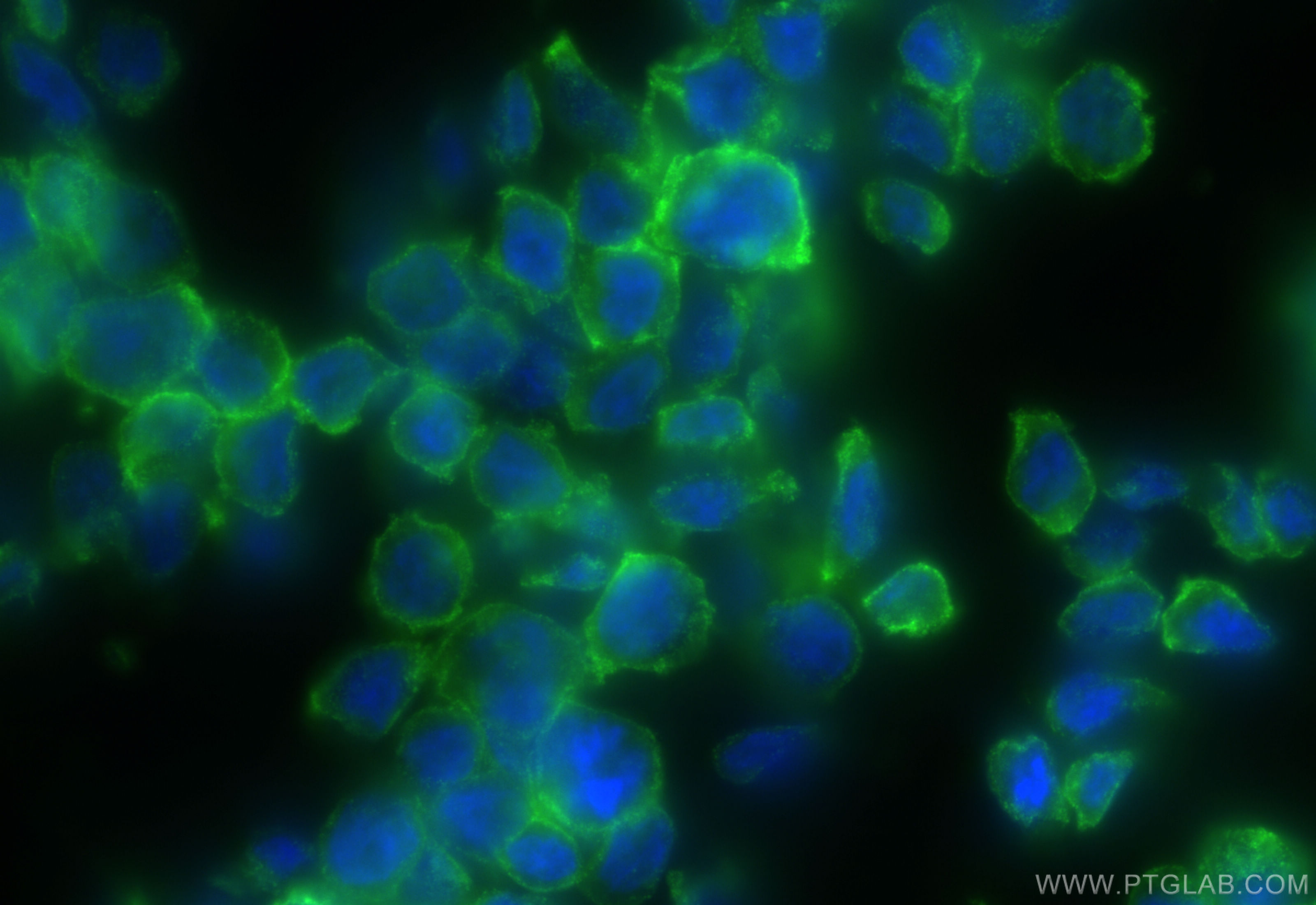 IF Staining of THP-1 using 83747-5-RR