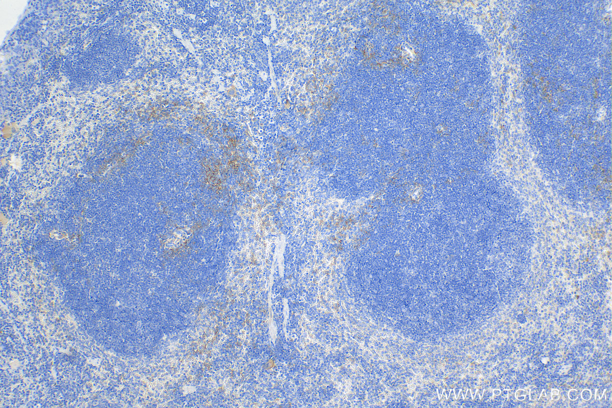 IHC staining of mouse spleen using 83795-7-RR (same clone as 83795-7-PBS)