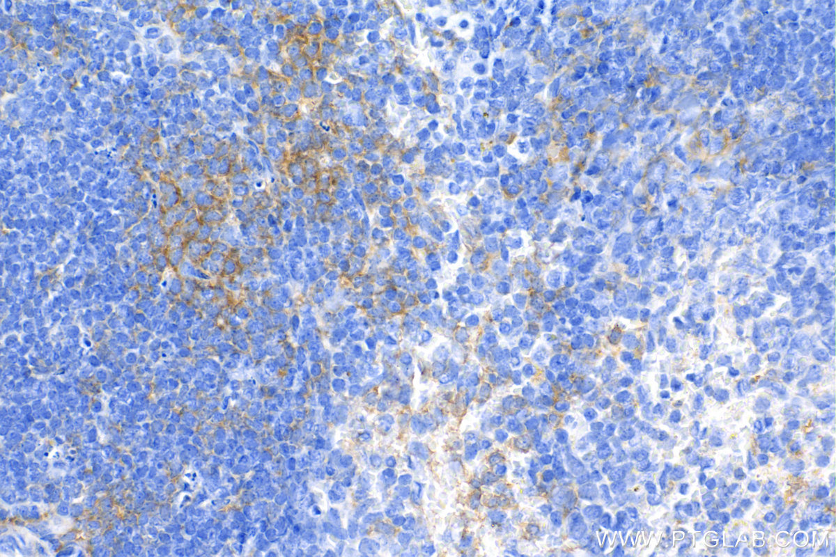 IHC staining of mouse spleen using 83795-7-RR (same clone as 83795-7-PBS)