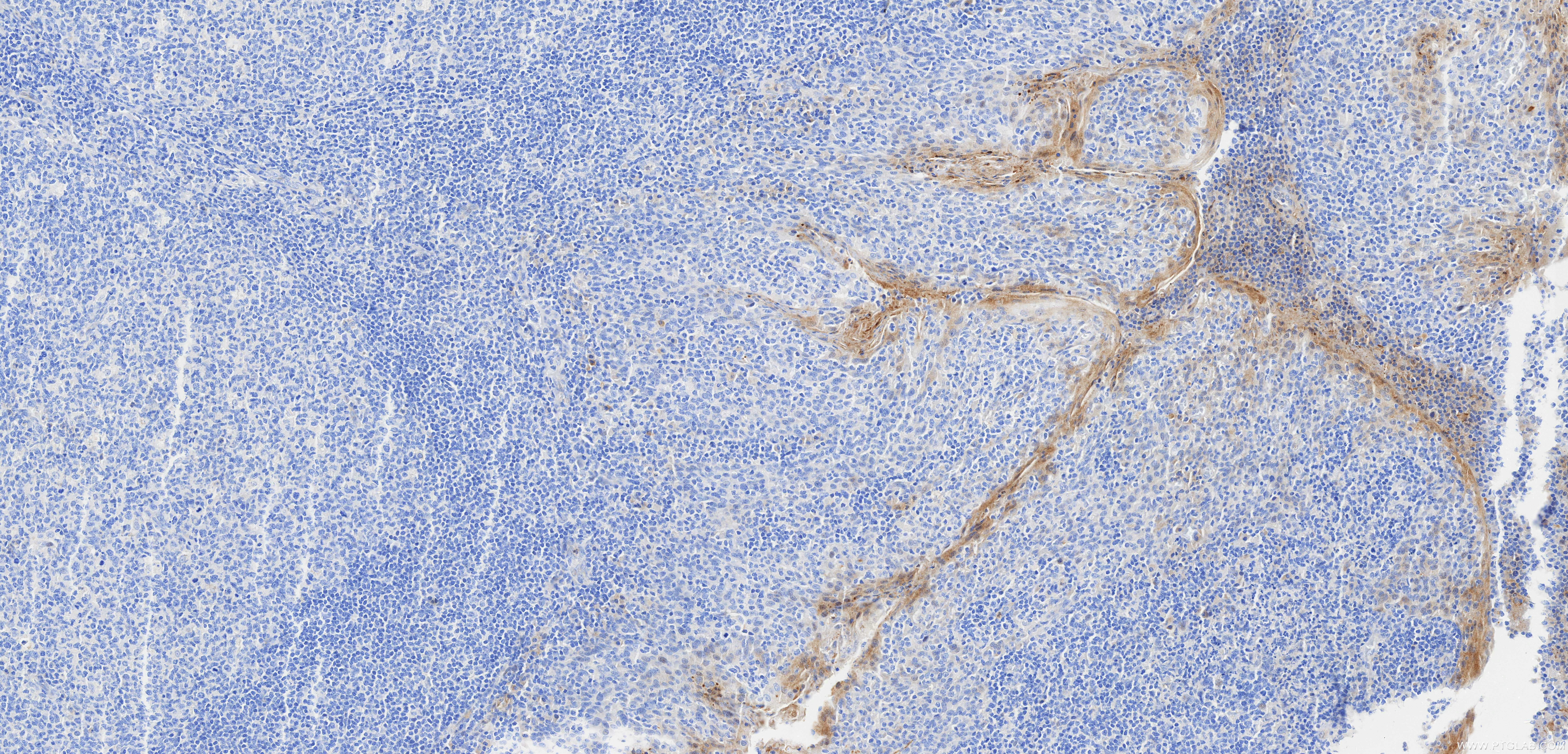 IHC staining of human tonsil using 98206-10-RR IHC staining of human tonsil using 98206-10-RR