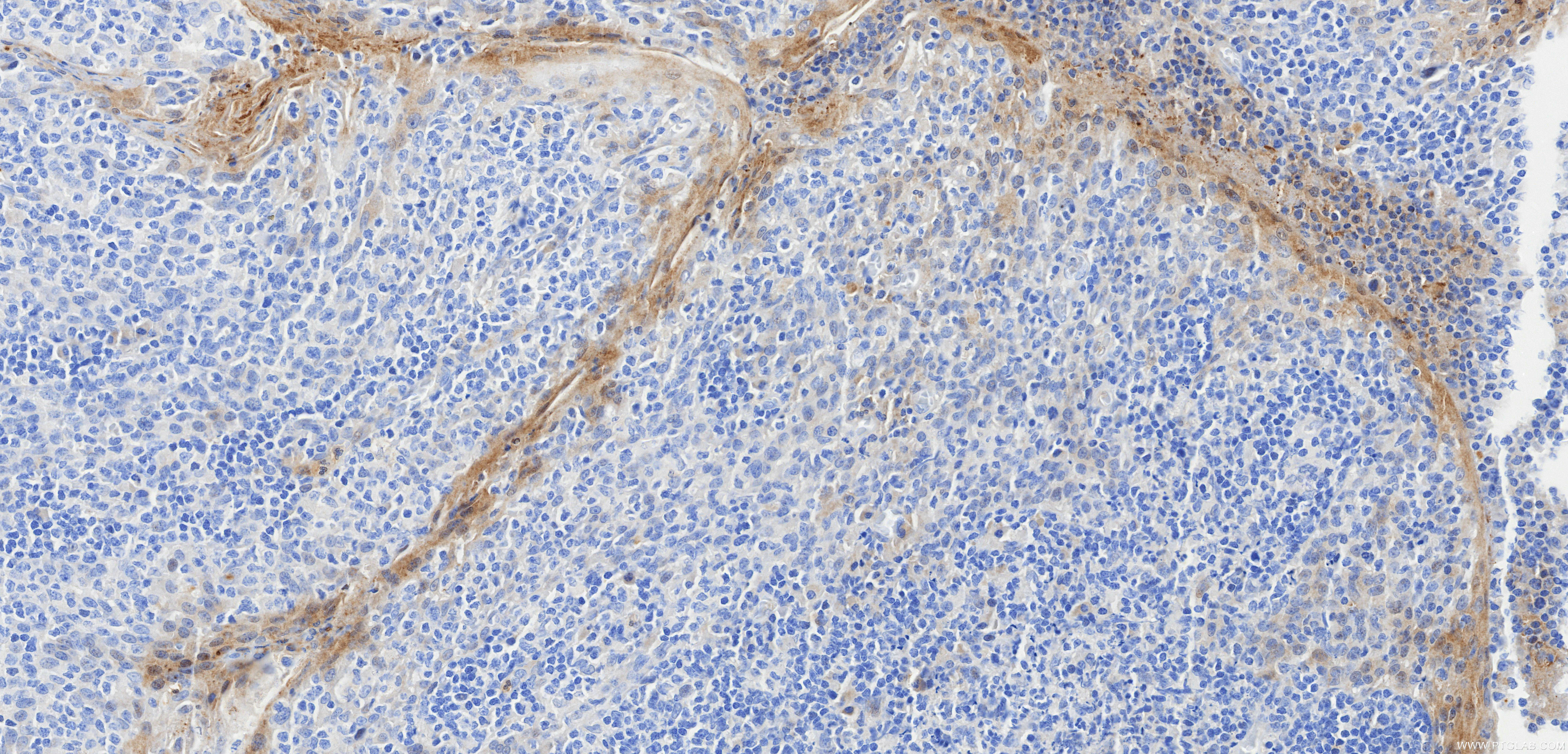 IHC staining of human tonsil using 98206-10-RR IHC staining of human tonsil using 98206-10-RR