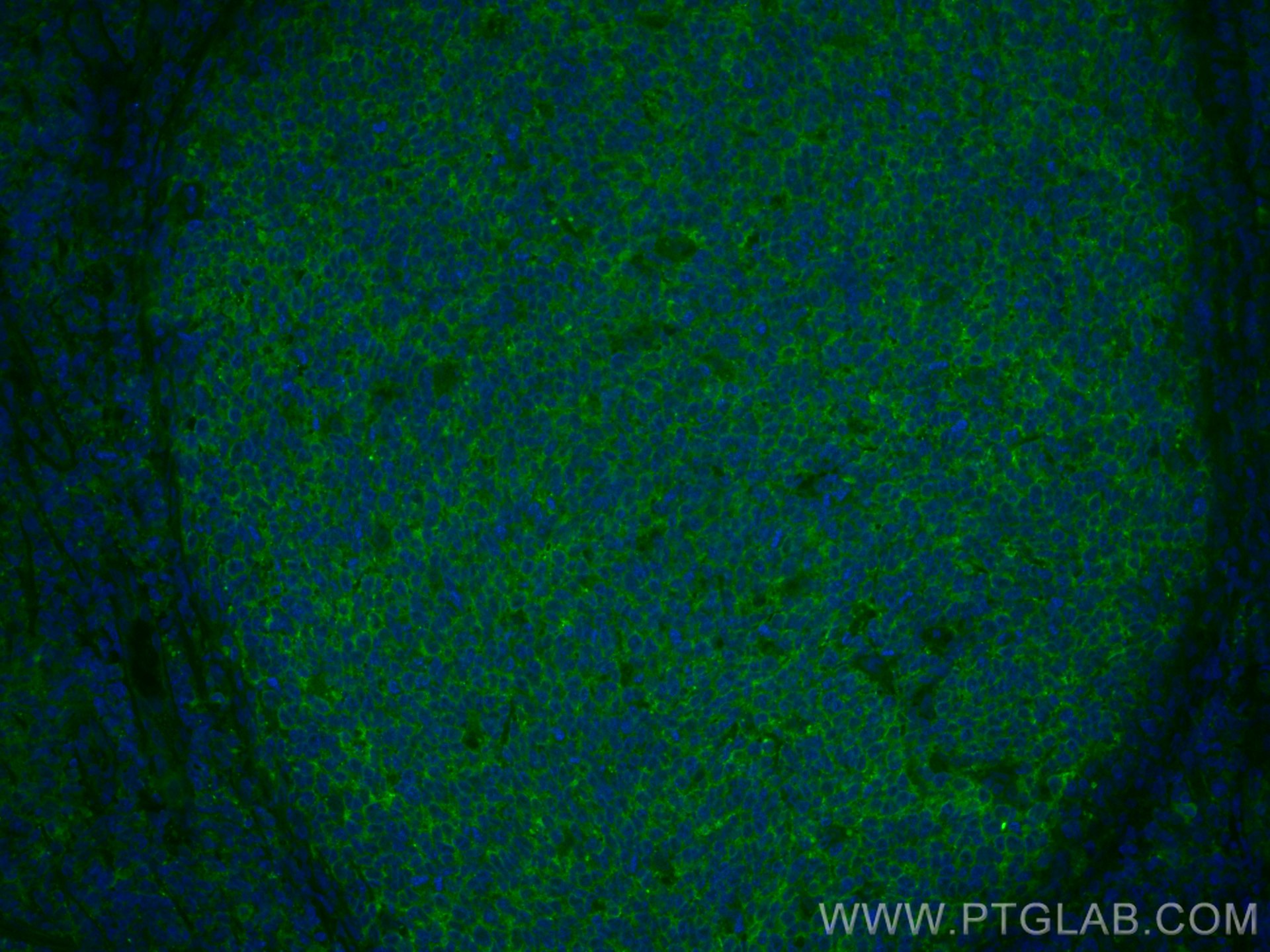 IF Staining of human tonsillitis using CL488-66144