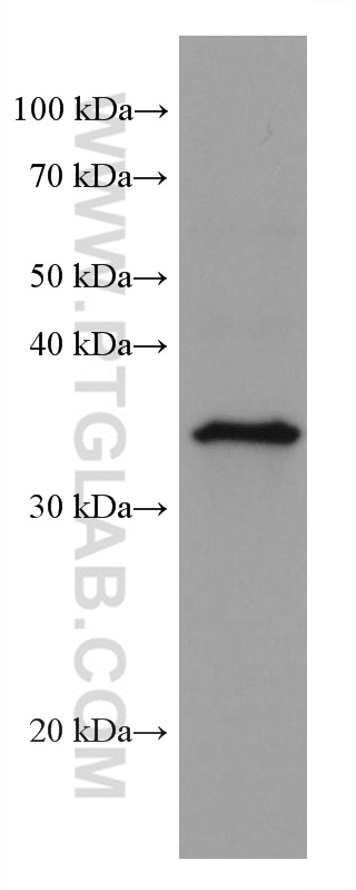 WB analysis of A431 using 66737-1-Ig