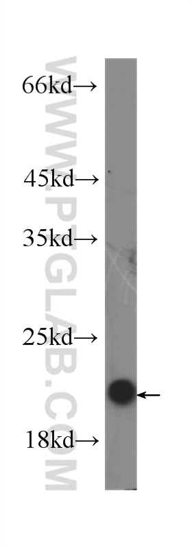 WB analysis of Recombinant protein using 60269-1-Ig (same clone as 60269-1-PBS)