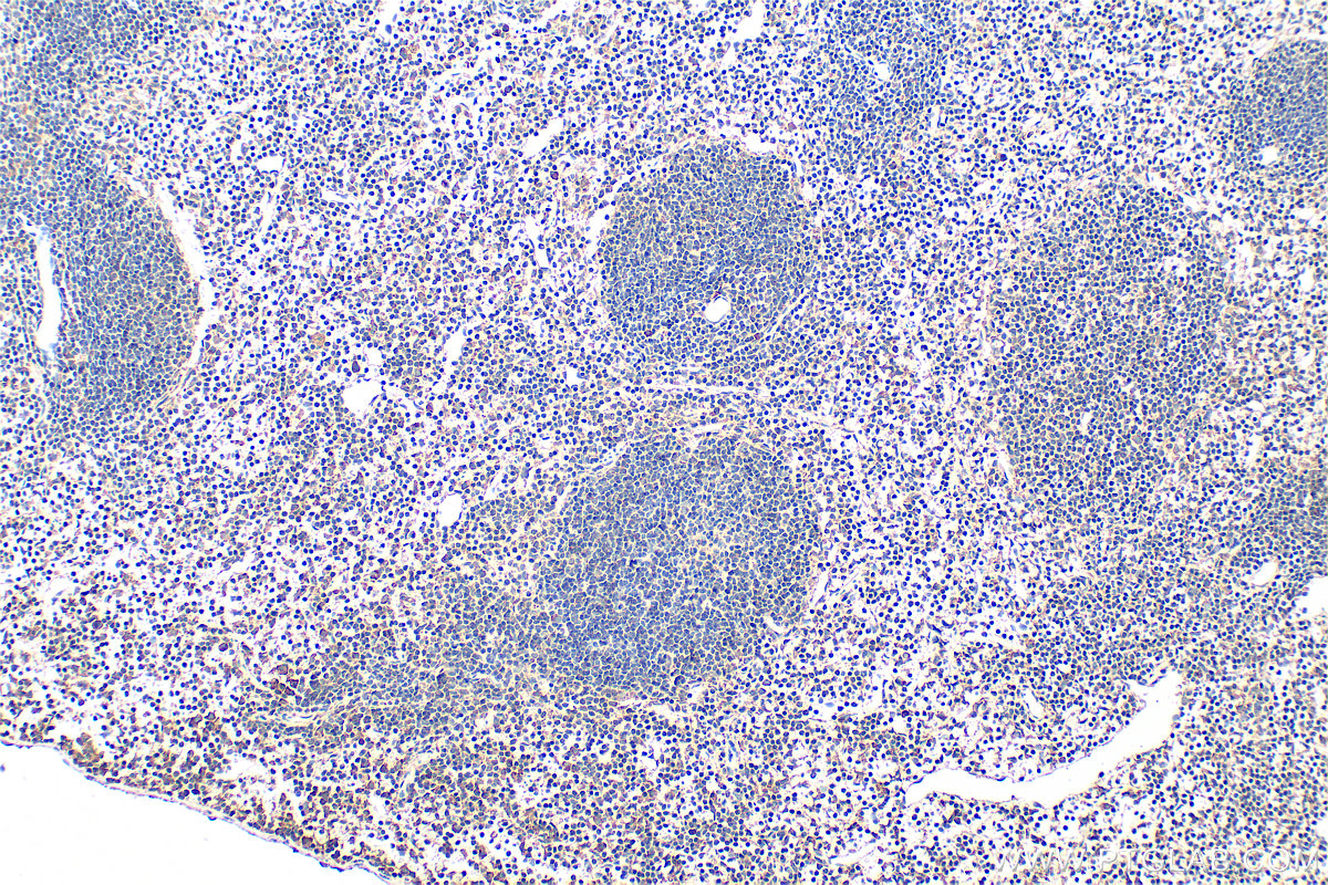 IHC staining of mouse spleen using 30756-1-AP