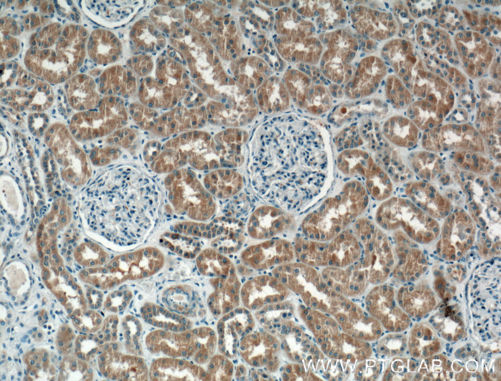 IHC staining of human kidney using 60324-1-Ig