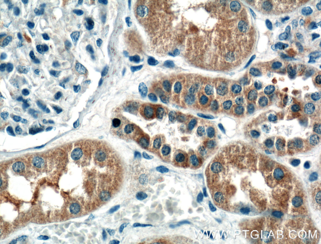 IHC staining of human kidney using 60324-1-Ig