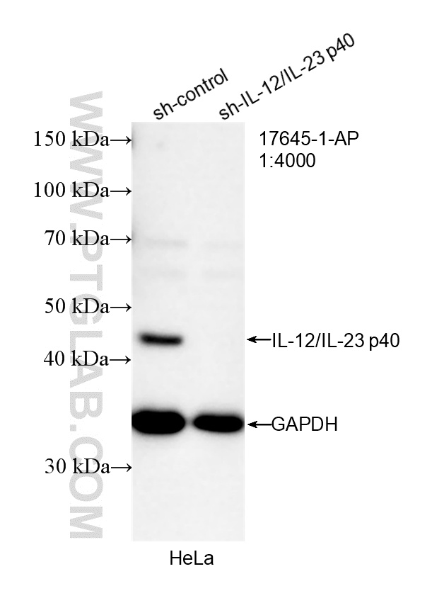 WB result of IL-12/IL-23 p40 antibody (17645-1-AP; 1:4000; incubated at room temperature for 1.5 hours) with sh-Control and sh-IL-12/IL-23 p40 transfected HeLa cells. WB analysis of HeLa using 17645-1-AP