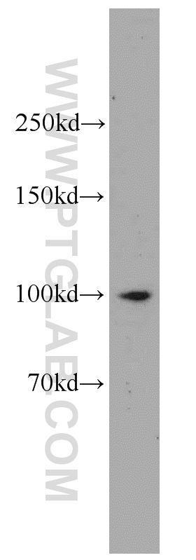 WB analysis of K-562 using 13287-1-AP