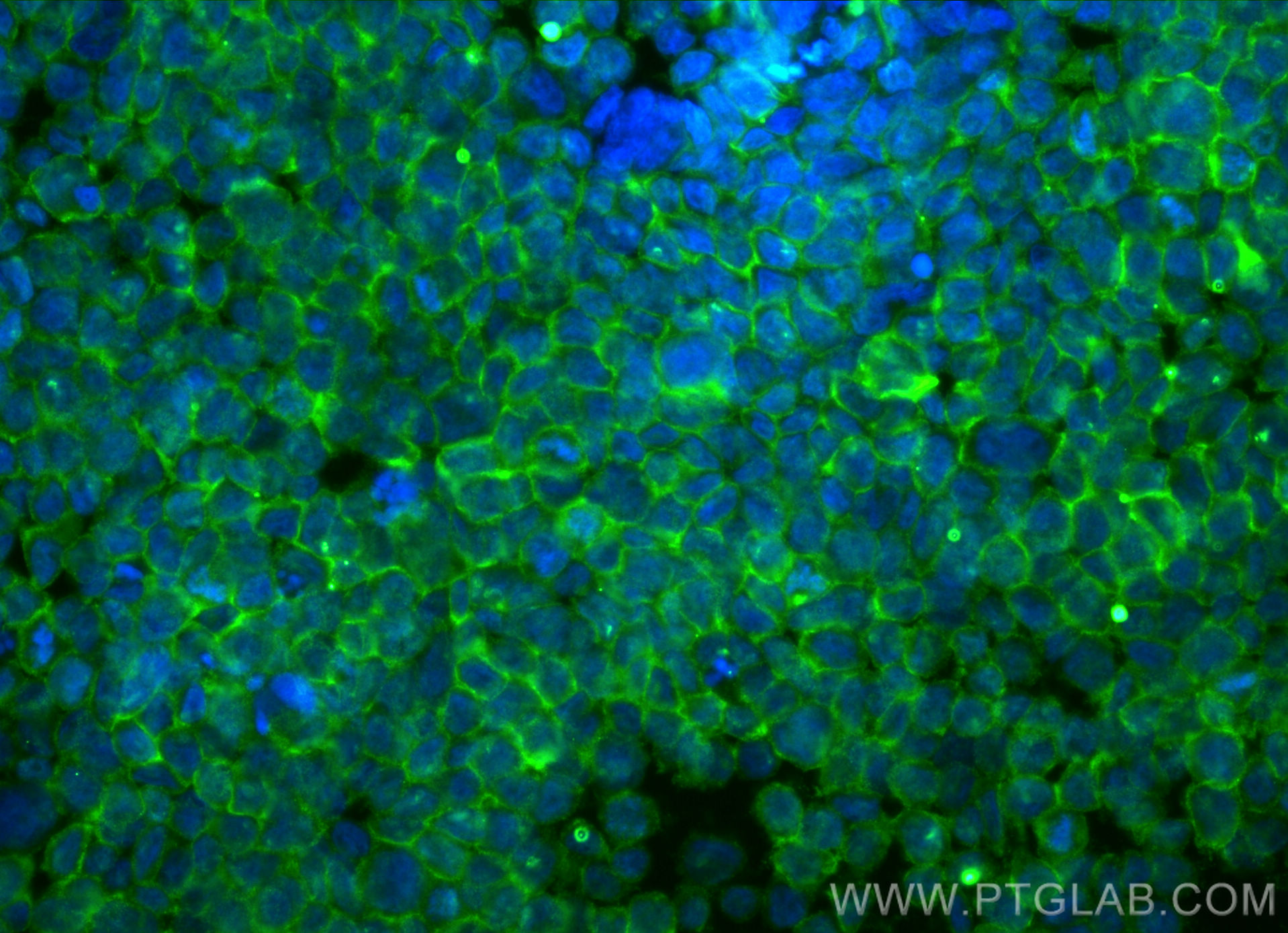 IF Staining of THP-1 using 66829-1-Ig