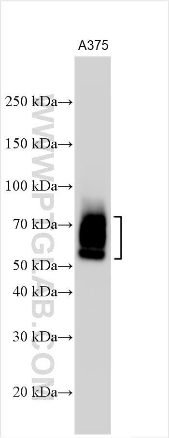 WB analysis using 11059-1-AP