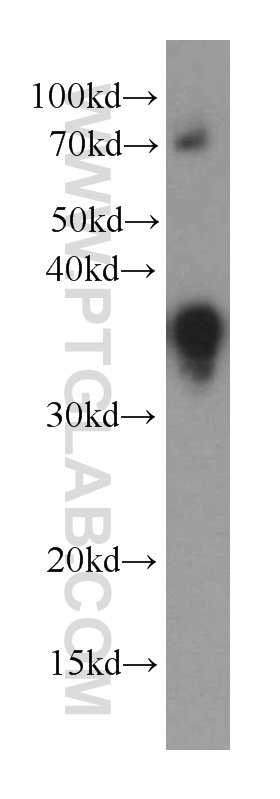 WB analysis of Recombinant protein using 66145-1-Ig