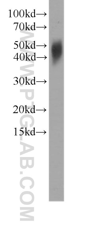 WB analysis of human brain using 60245-1-Ig