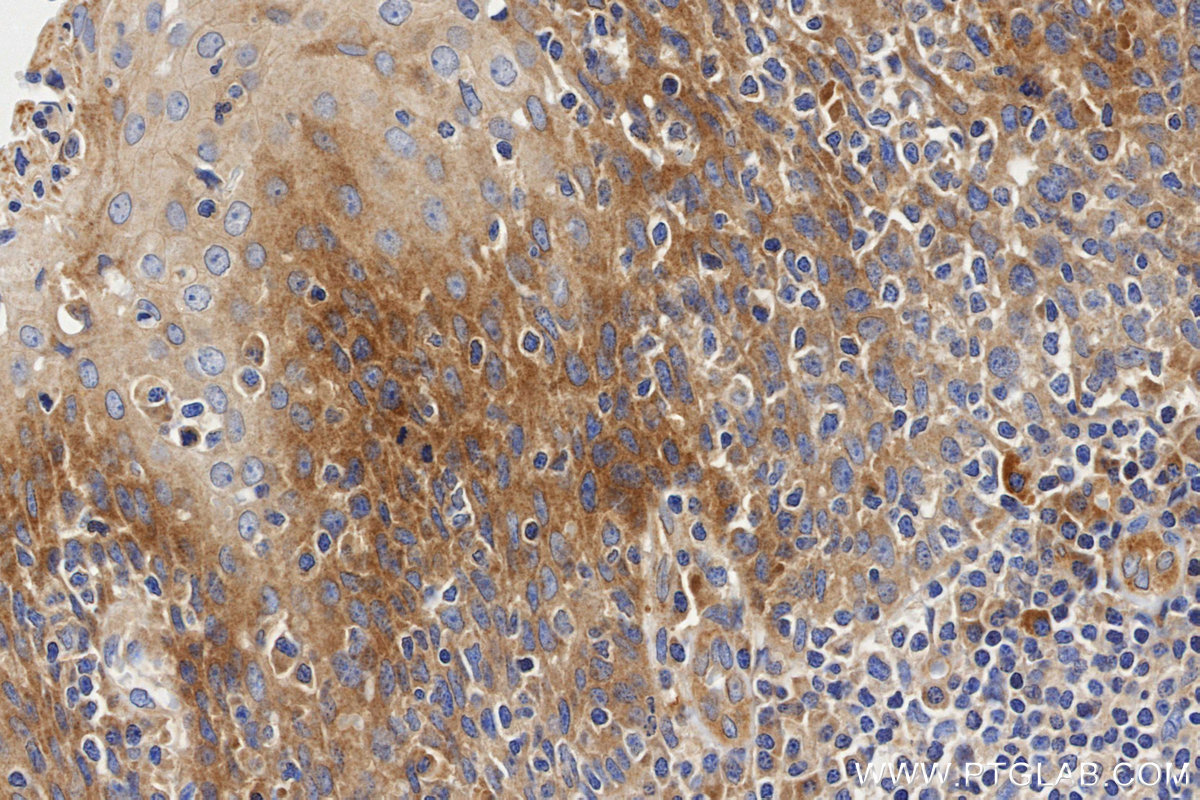 IHC staining of Human Tonsil using 84535-2-RR