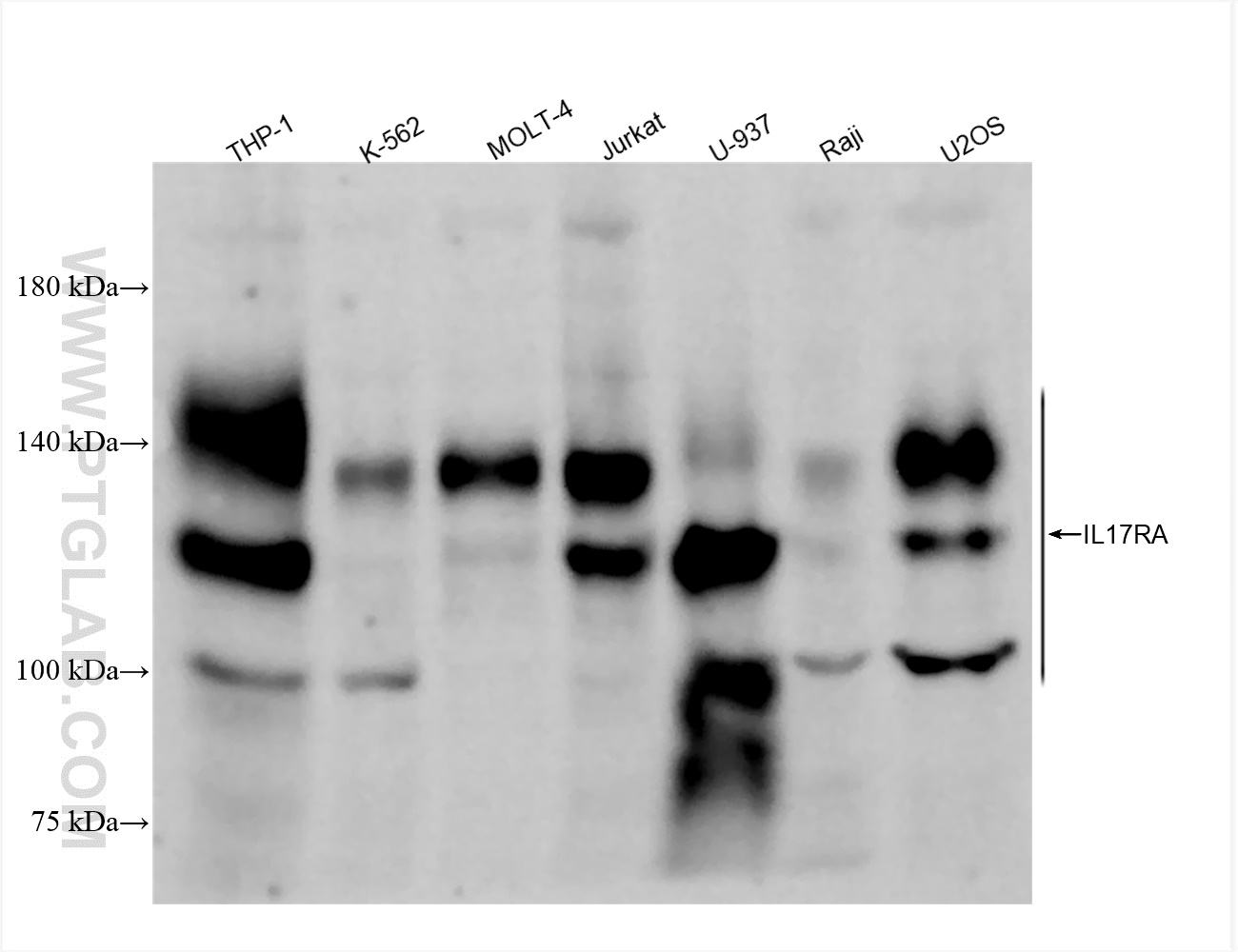WB analysis using 84535-2-RR (same clone as 84535-2-PBS)
