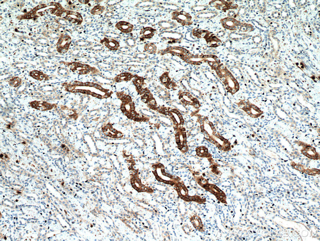 IHC staining of human kidney using 20673-1-AP