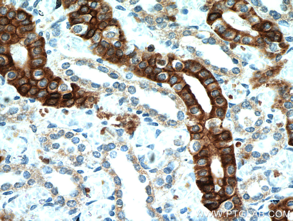 IHC staining of human kidney using 20673-1-AP