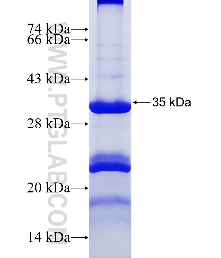 IL17RB fusion protein Ag37458 SDS-PAGE