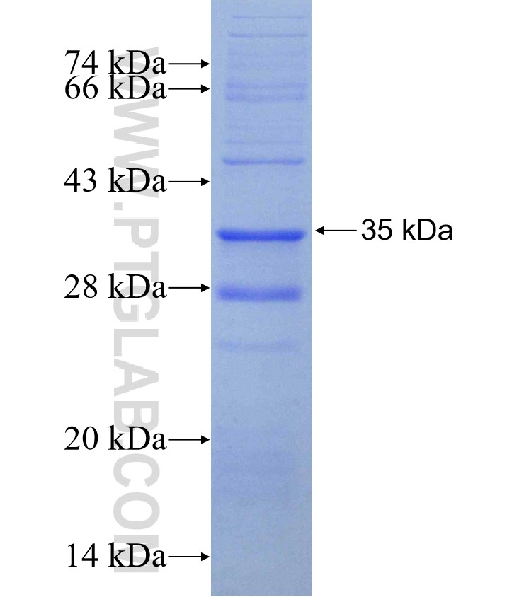 IL17RD fusion protein Ag30102 SDS-PAGE IL17RD fusion protein Ag30102 SDS-PAGE