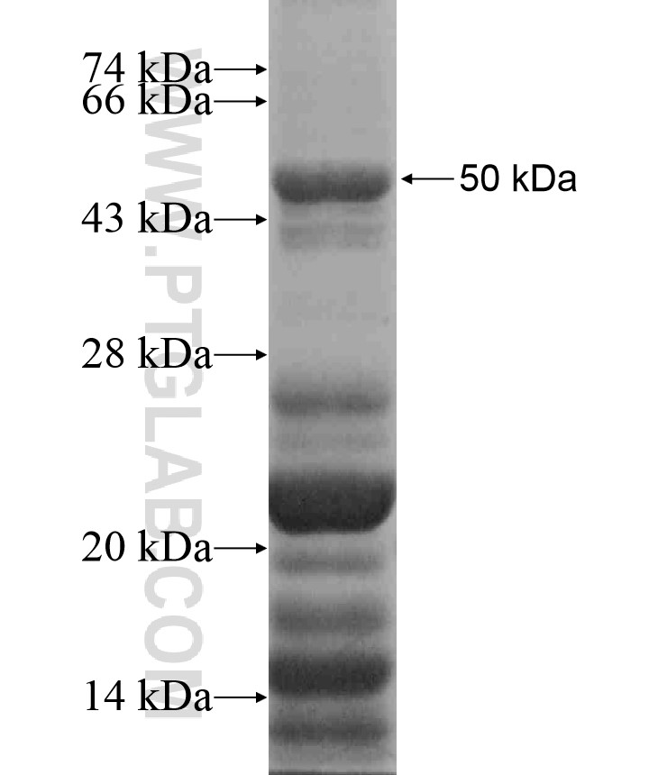 IL-17RD fusion protein Ag17286 SDS-PAGE IL-17RD fusion protein Ag17286 SDS-PAGE