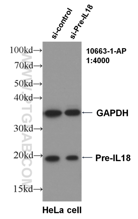 WB analysis of HeLa using 10663-1-AP