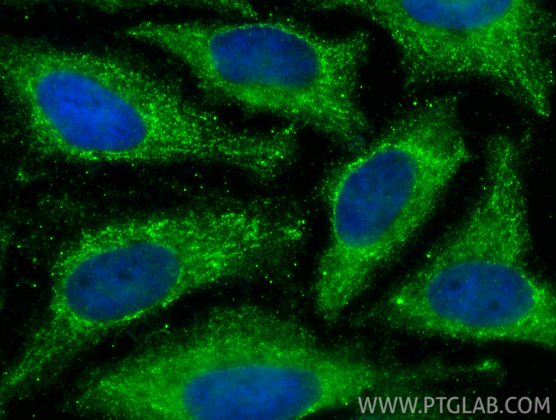 Immunofluorescent analysis of (-20°C Ethanol) fixed HeLa cells using IL-18 antibody (60070-1-Ig, Clone: 5C6F8 ) at dilution of 1:400 and CoraLite®488-Conjugated Goat Anti-Mouse IgG(H+L) (<a class='green' href='/productredirect?CatalogNo=SA00013-1' target='_blank'>SA00013-1</a>). IF Staining of HeLa using 60070-1-Ig