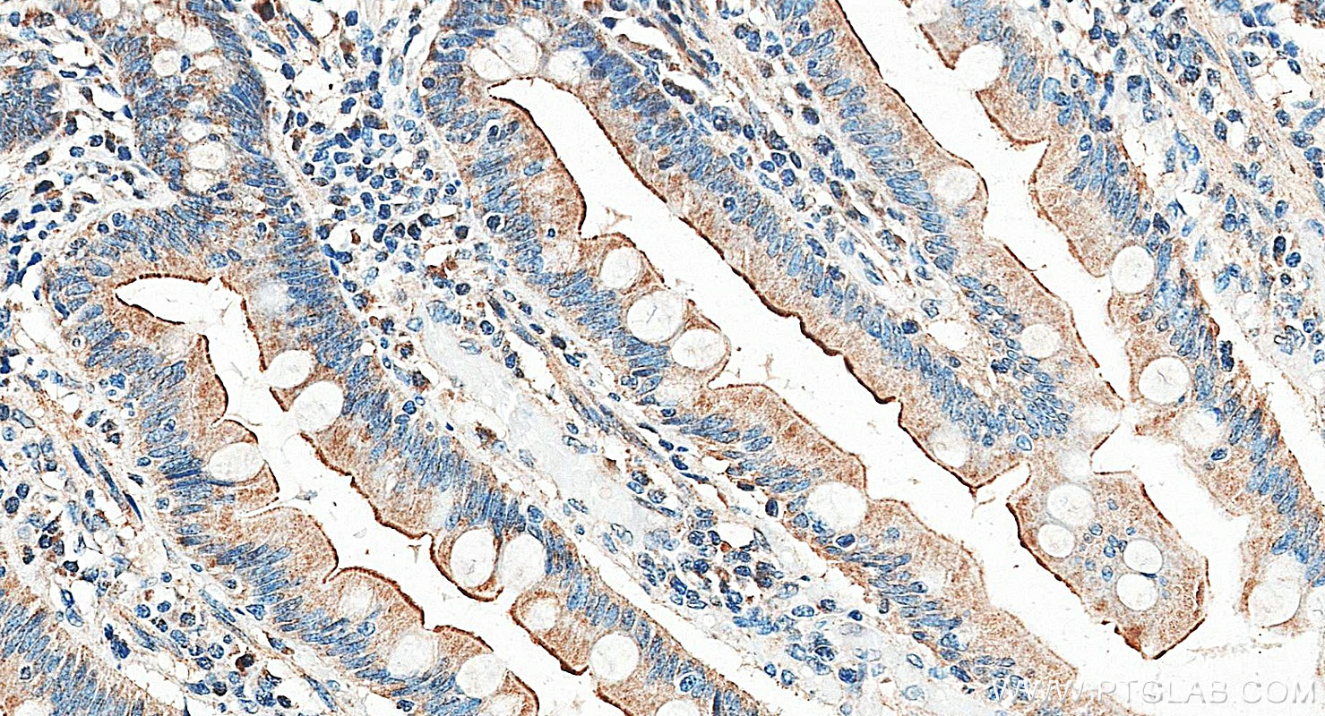 IHC staining of human small intestine using 30587-1-AP (same clone as 30587-1-PBS)