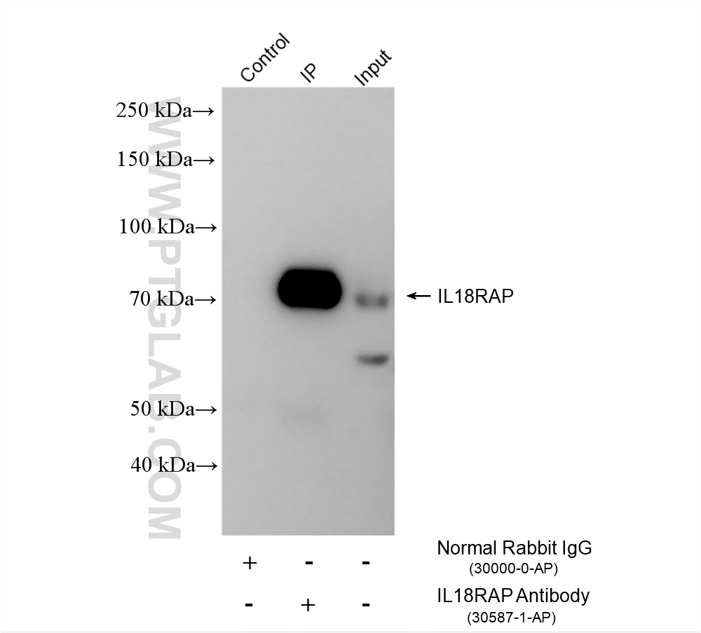 IP experiment of mouse spleen using 30587-1-AP (same clone as 30587-1-PBS)
