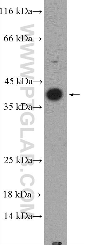 IL-1 Beta Polyclonal antibody