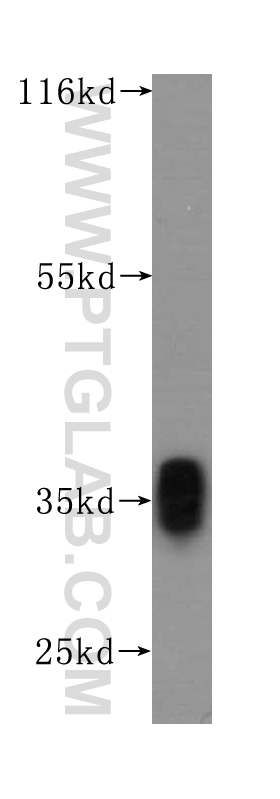 WB analysis of Recombinant protein using 60136-1-Ig