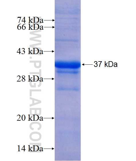 IL-1 beta fusion protein Ag10466 SDS-PAGE IL-1 beta fusion protein Ag10466 SDS-PAGE